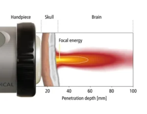 ภาพการรักษาโรคสมองเสื่อม