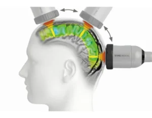 ภาพการรักษาโรคสมองเสื่อม