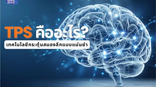 นวัตกรรมใหม่ในการรักษาโรคสมองเสื่อมด้วย TPS