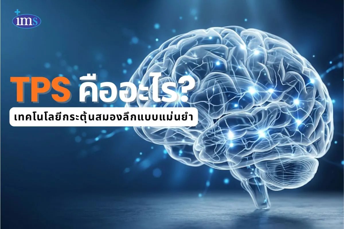 นวัตกรรมใหม่ในการรักษาโรคสมองเสื่อมด้วย TPS
