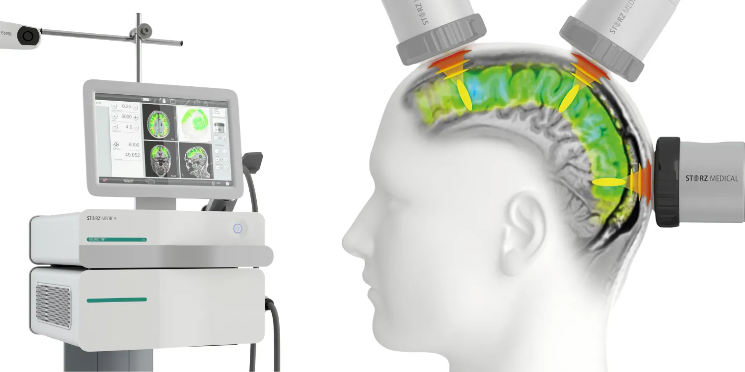 หลักการทำงานของ TPS